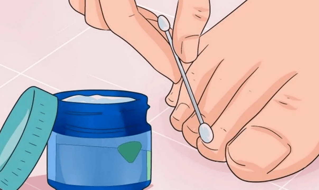 behandeling